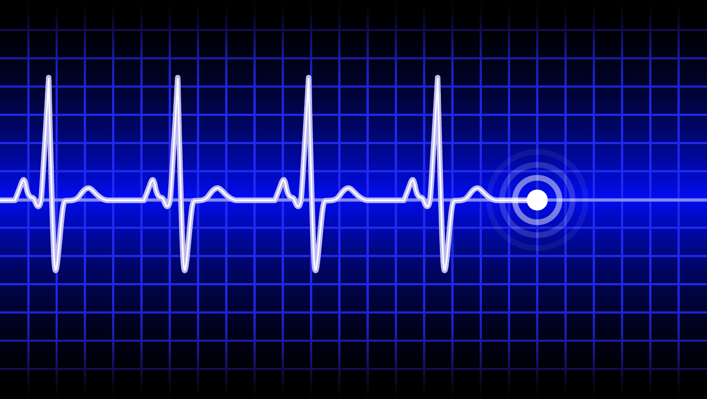 Abbott’s three big heart deals have one thing in common