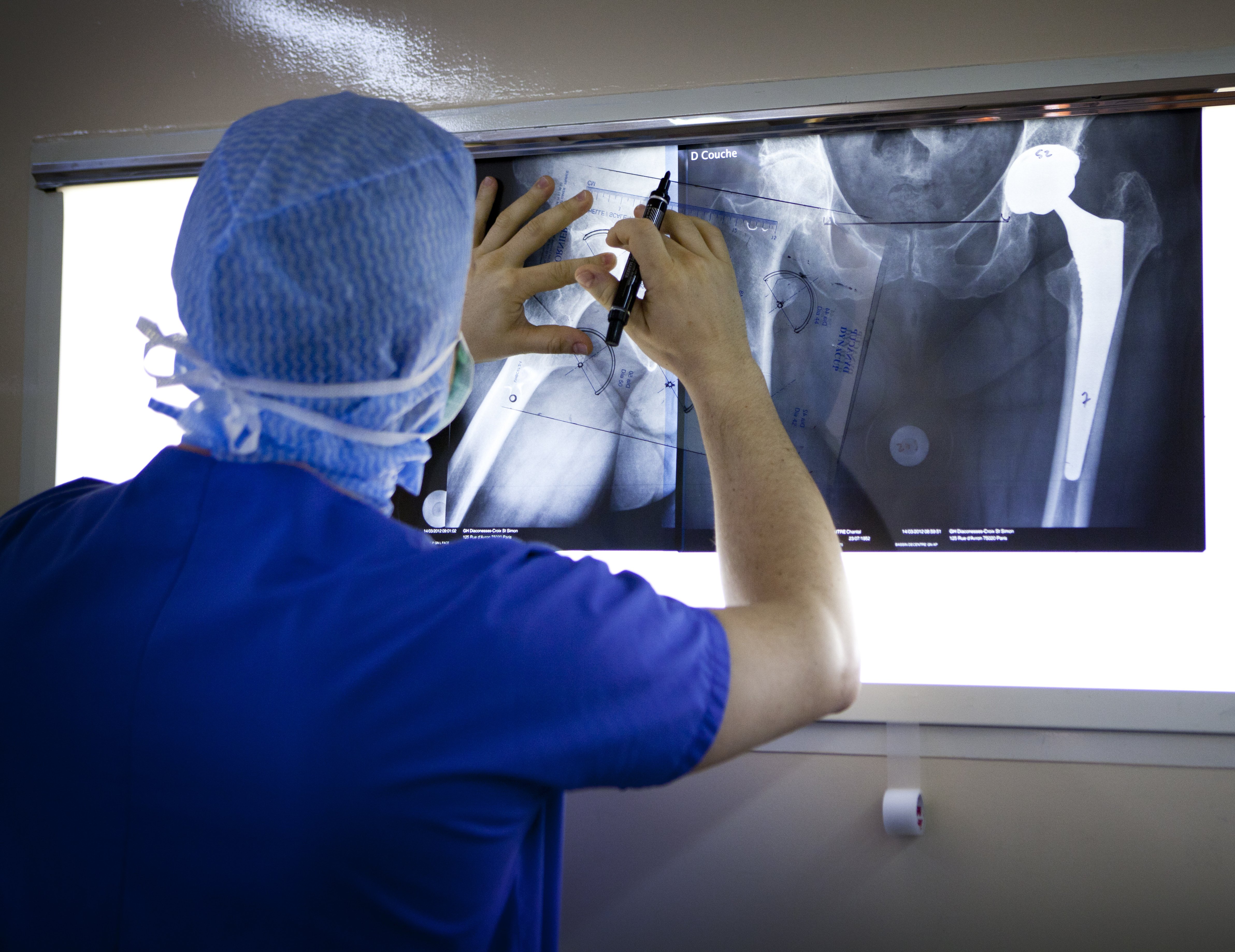Hip Prosthesis, Surgery X-rays