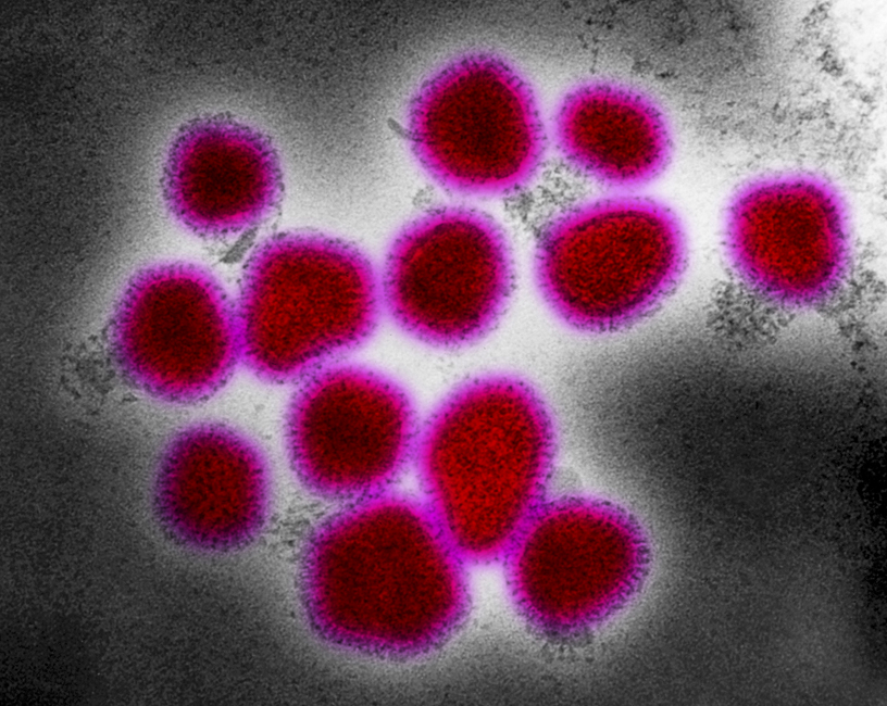 Negatively-stained Hong Kong Flu Virus