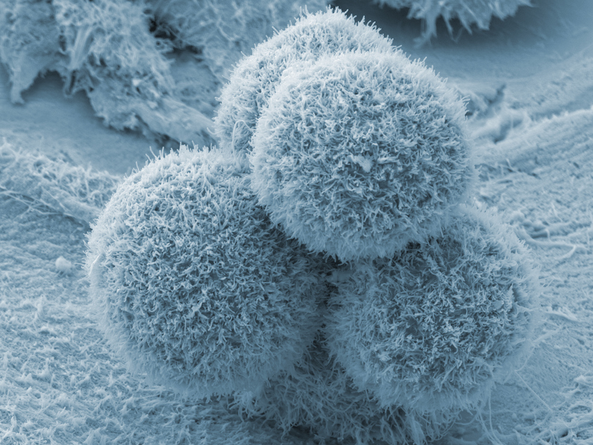 pancreatic cancer cell