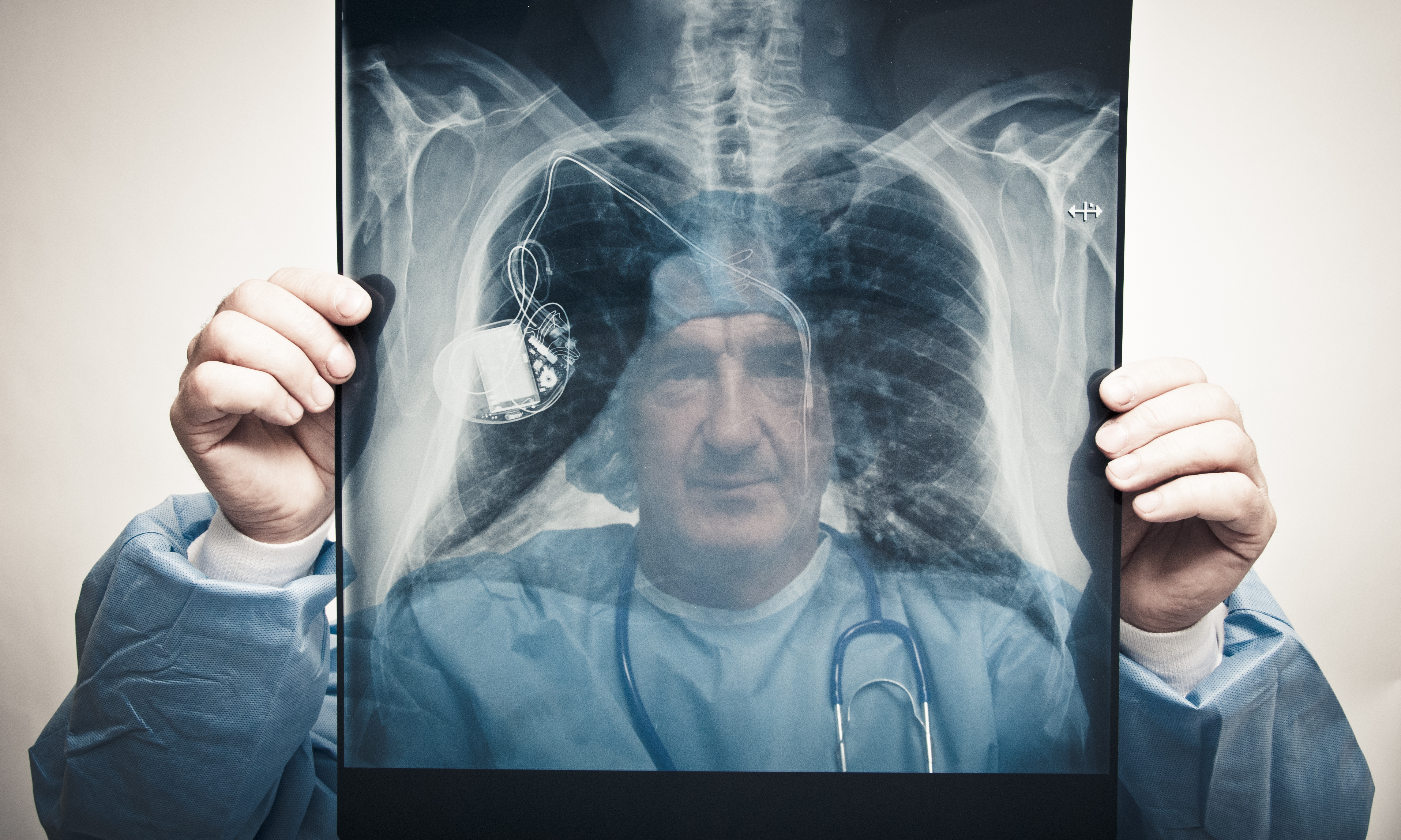 Doctor examining pacemaker on chest x-ray