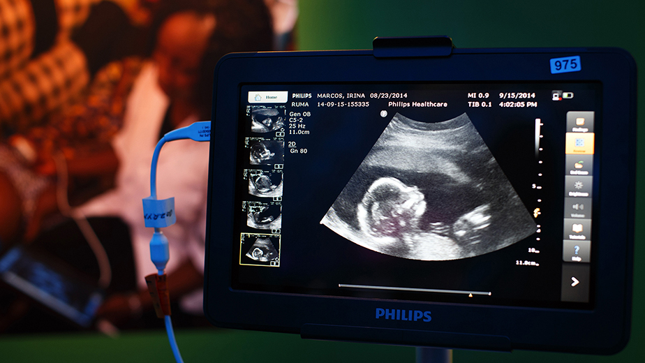 Royal Philips NV Chief Executive Officer Frans Van Houten Speaks At Innovation Day