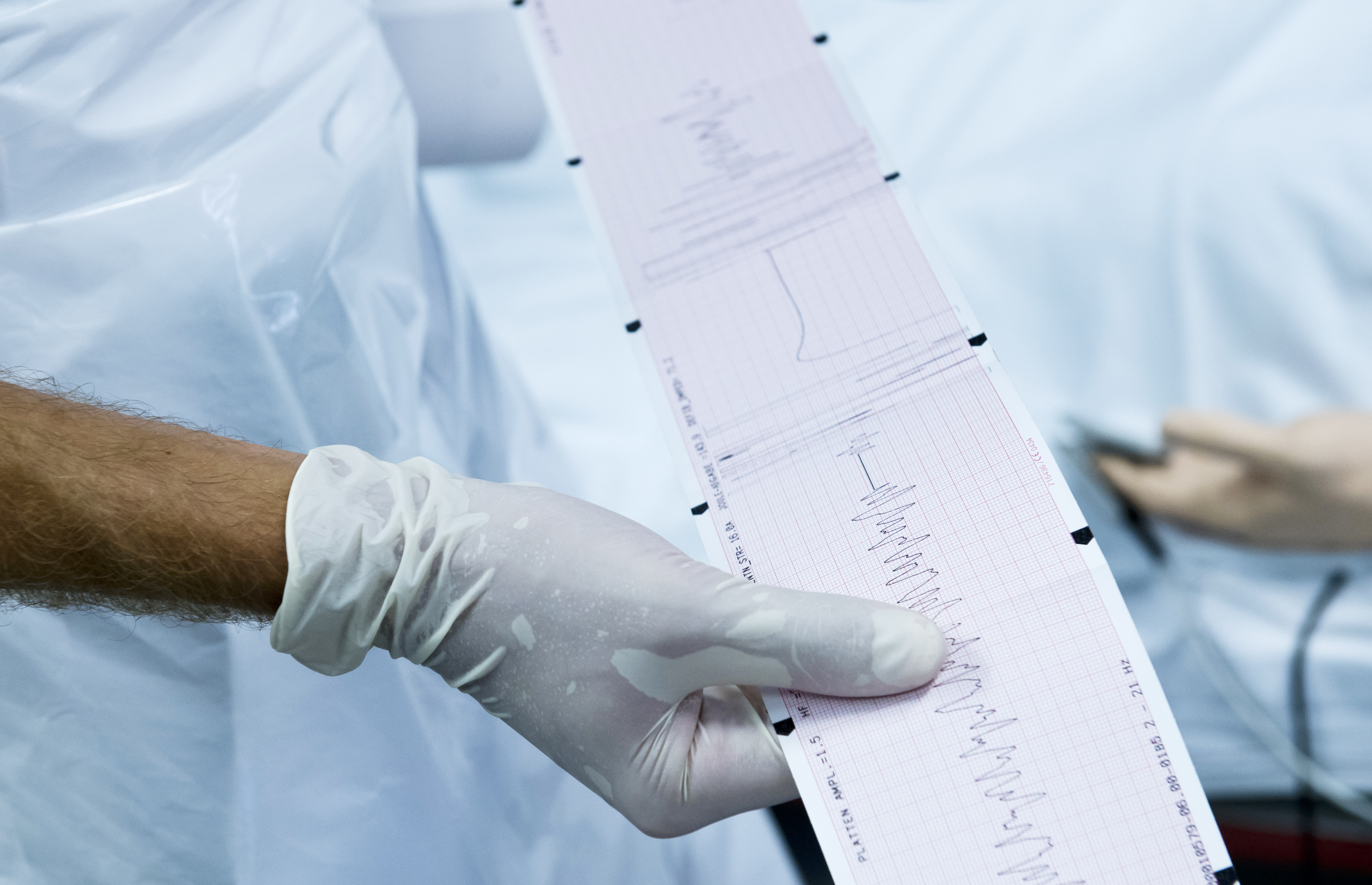 Elektrocardiogram