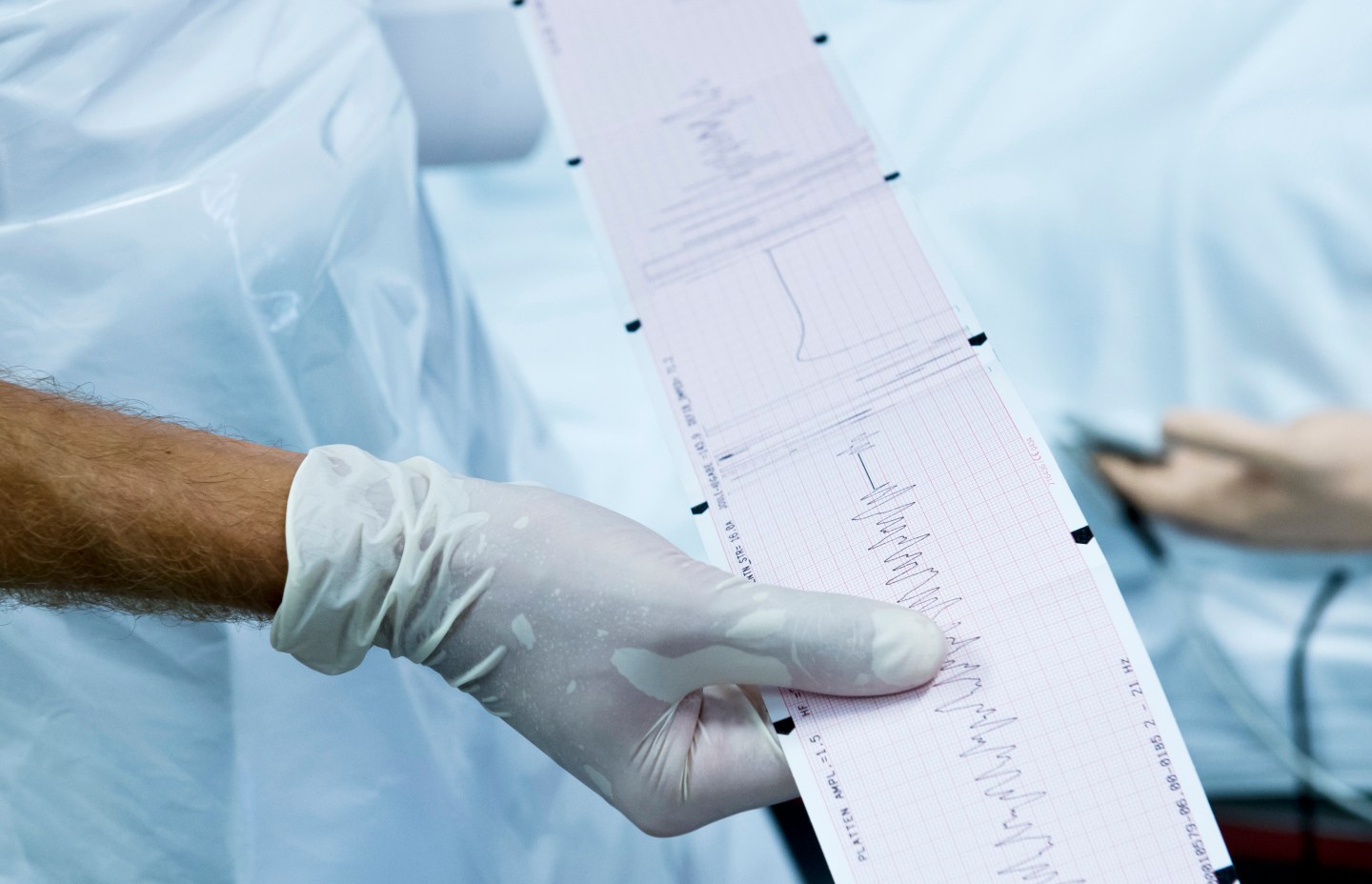 Elektrocardiogram