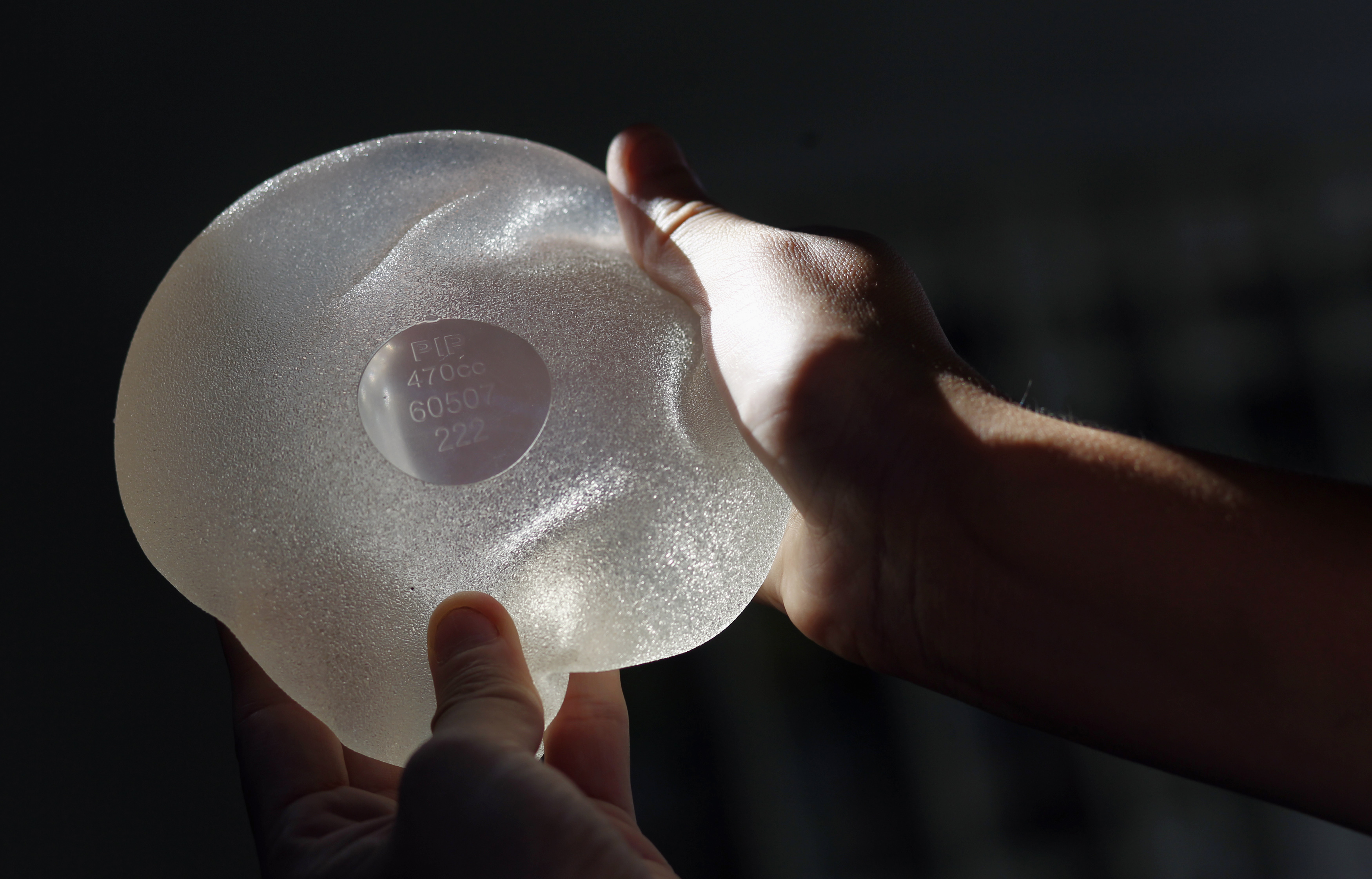 Rolon holds one of the silicone gel breast implants manufactured by PIP that she had to have removed, during an interview with Reuters in Buenos Aires