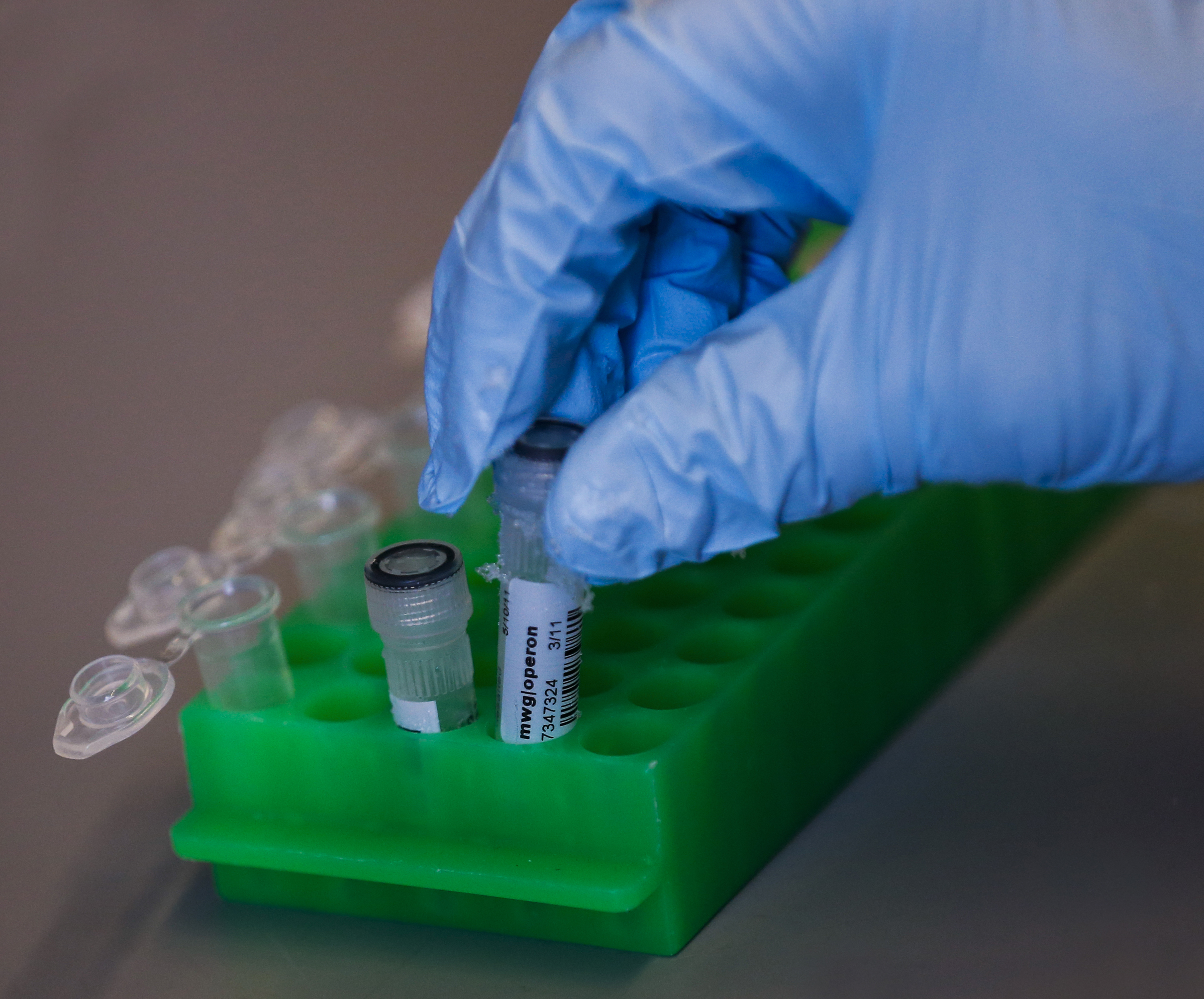 Researchers bring gene editing to patients with deadly diseases