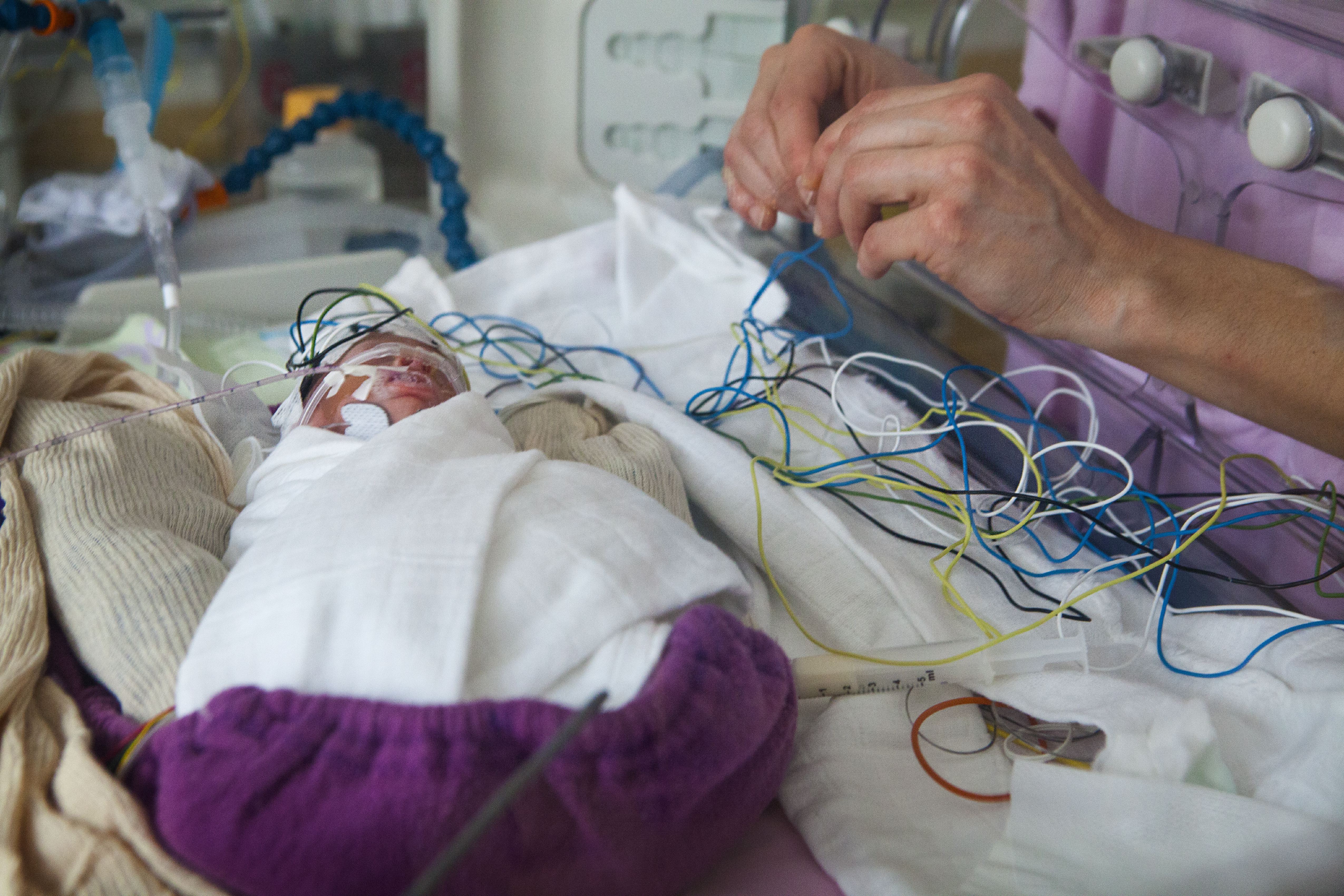 Neonatology