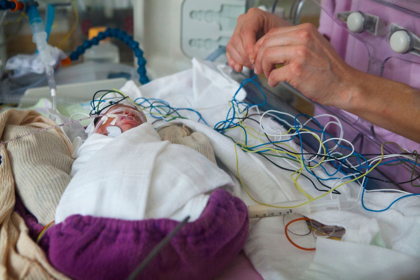Neonatology