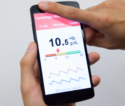 Senosis's HemaApp hemoglobin-reading app. The company has reportedly been bought by Google.