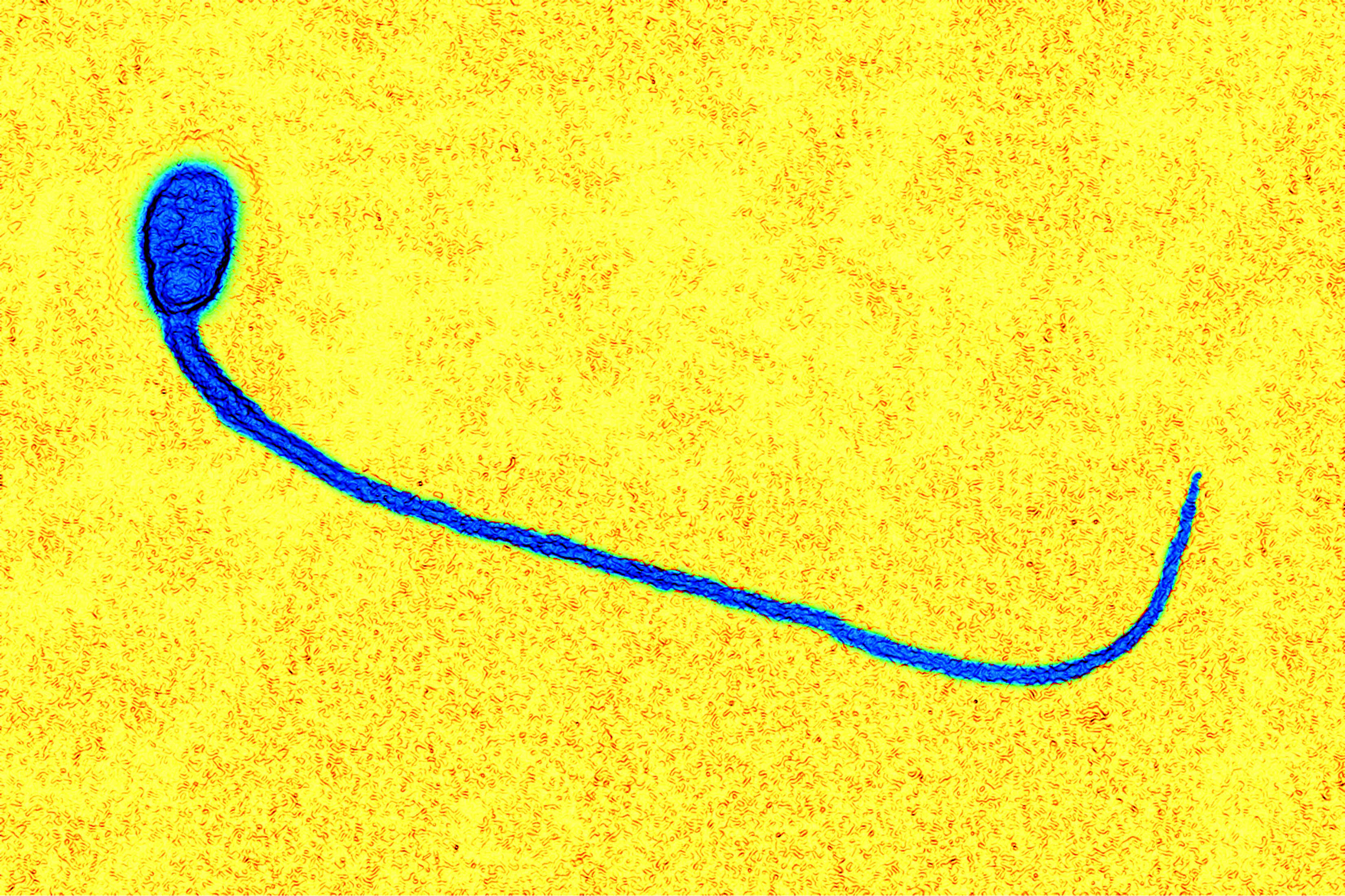 digital-light-sperm-microscope