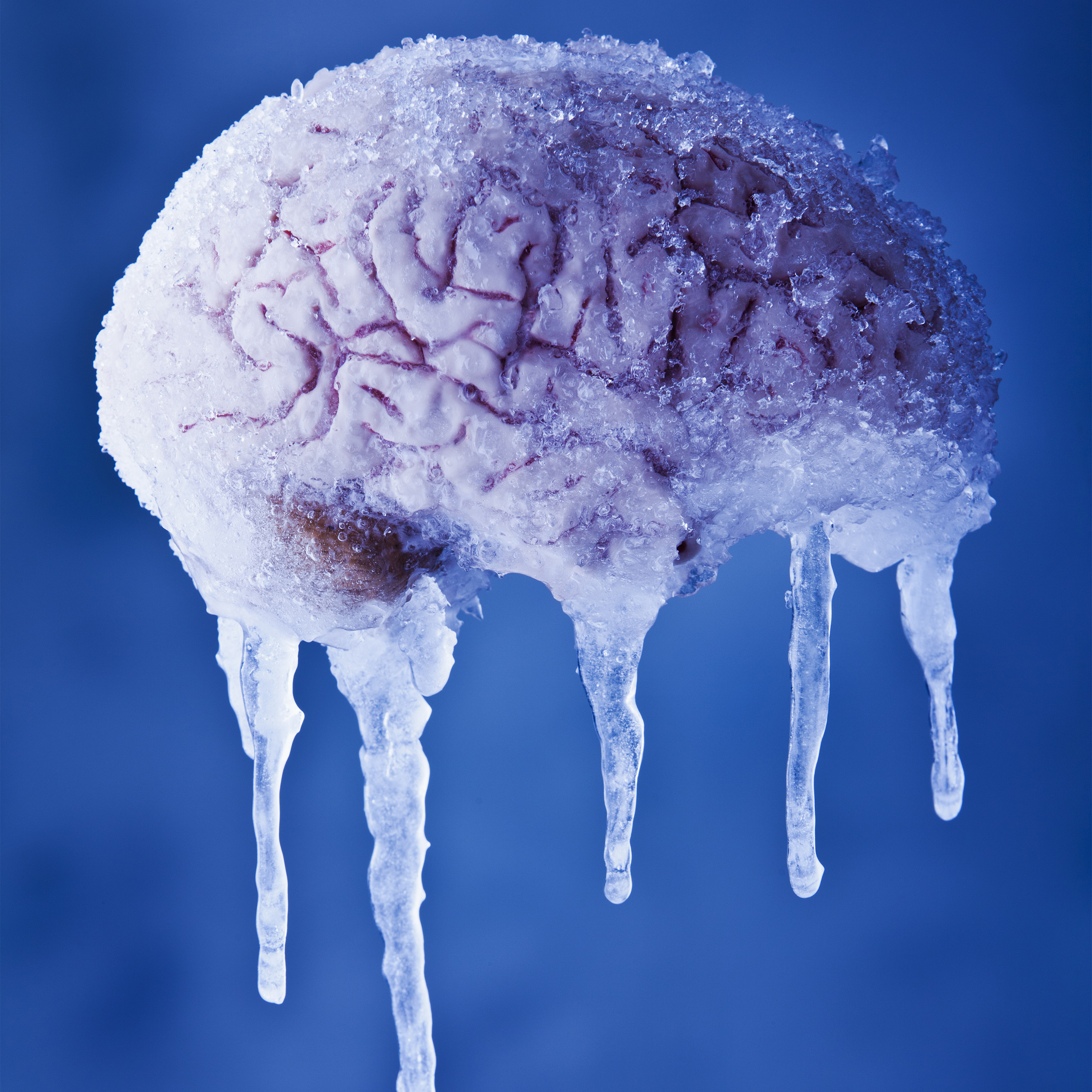 netcome-mit-contract-brain-preserve