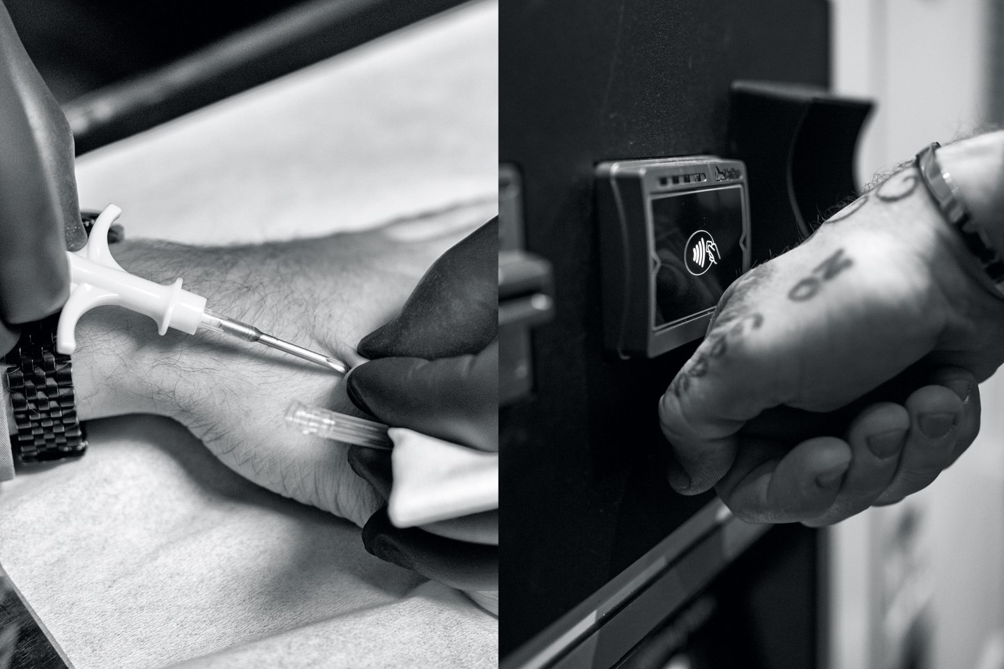 Is ‘Biochipping’ A Good Idea?