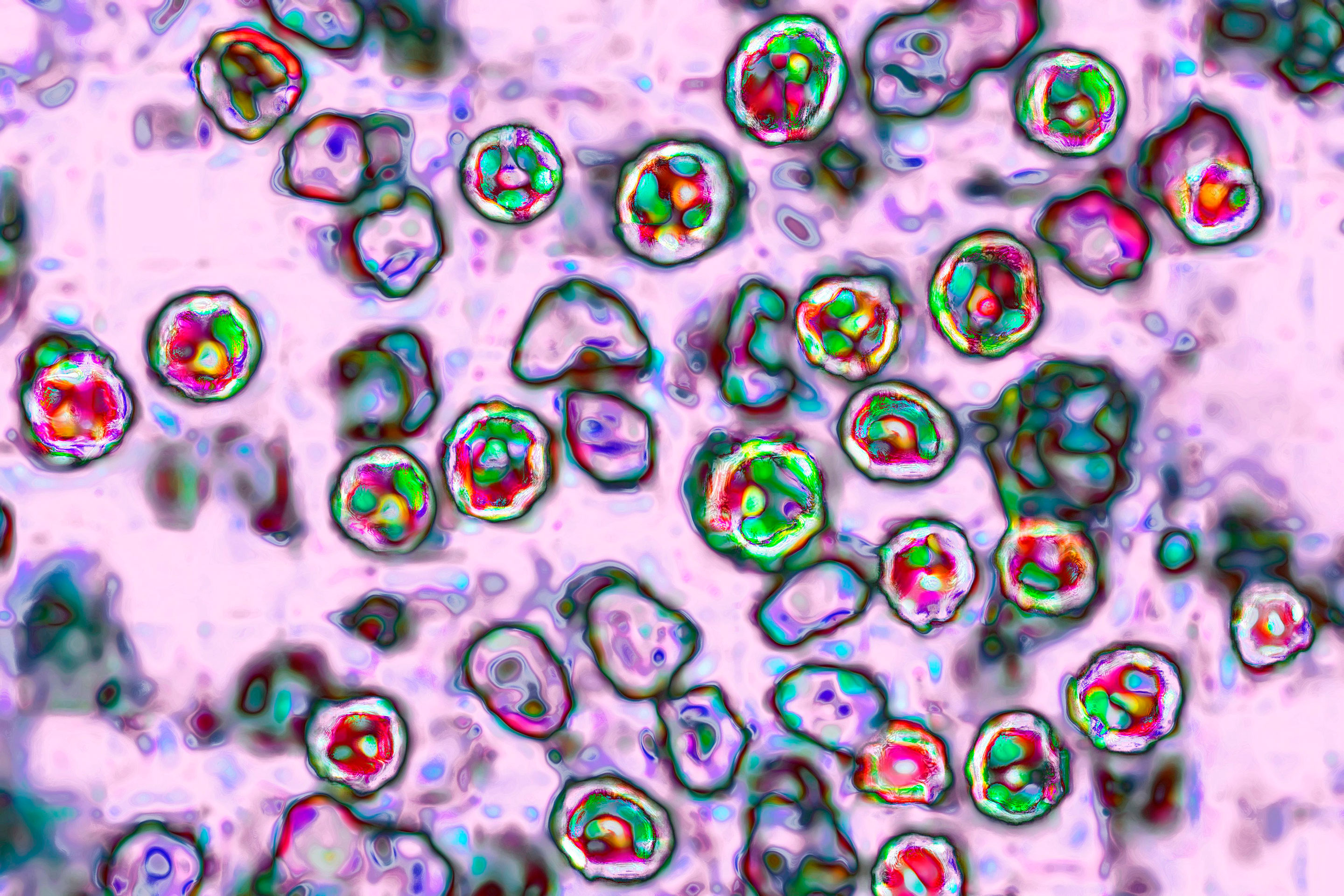 measles-virus