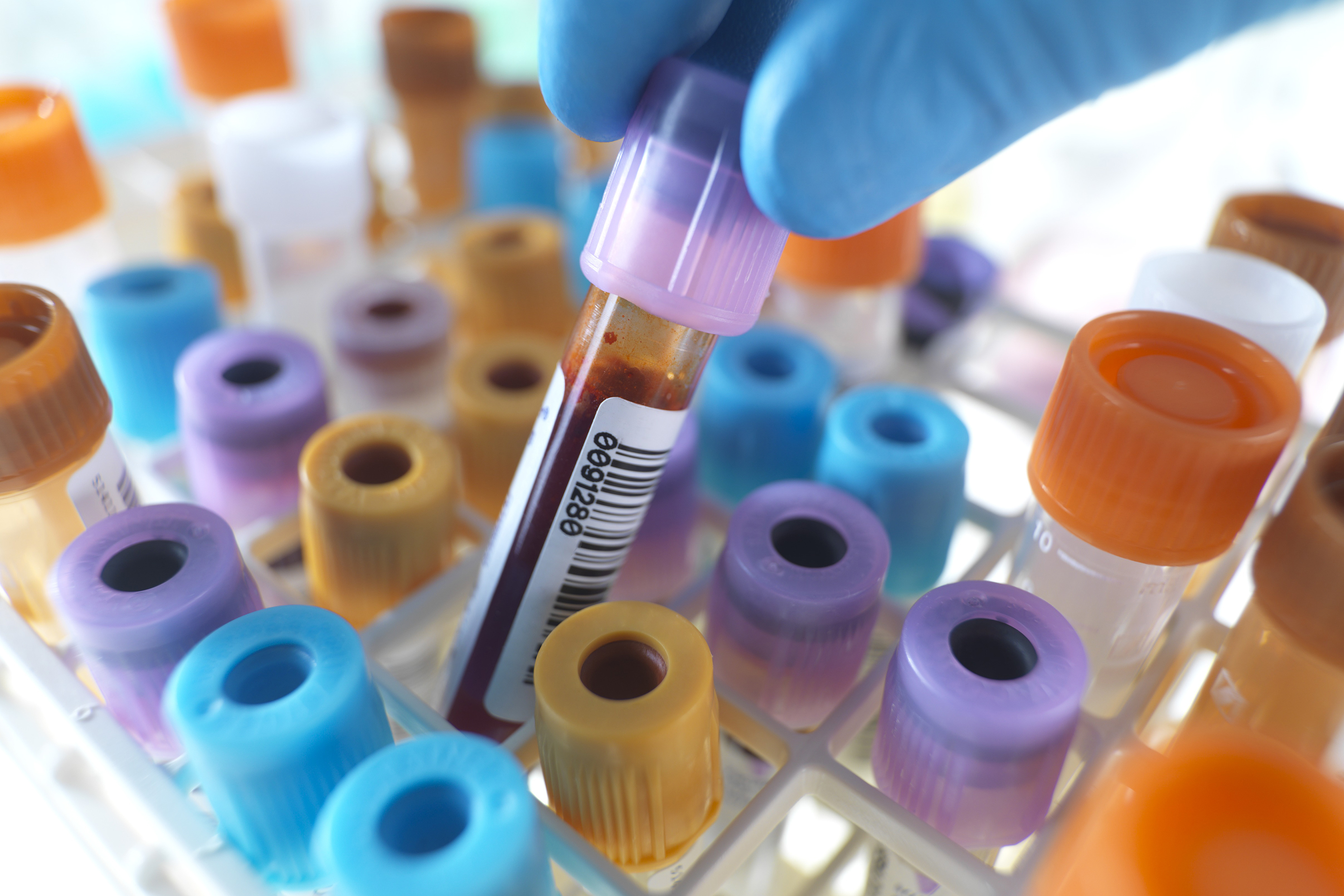 quest diagnostics data breach blood test