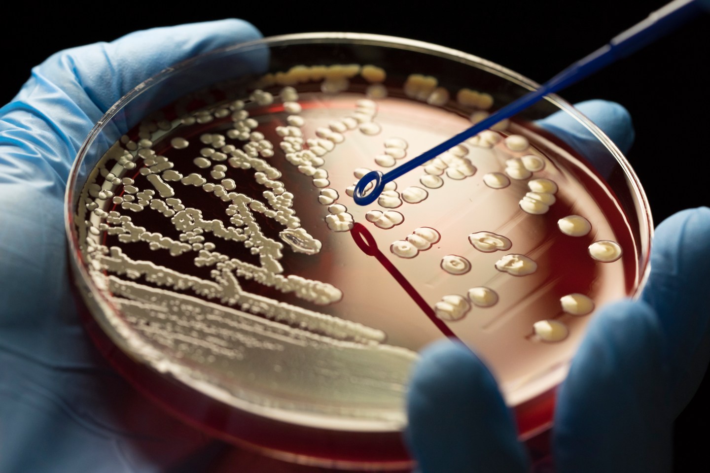 Superbugs Infecting Millions CDC