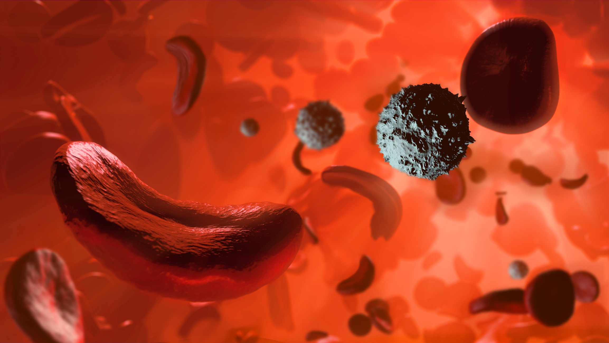 Vertex CRISPR Sickle Cell Blood Disorders