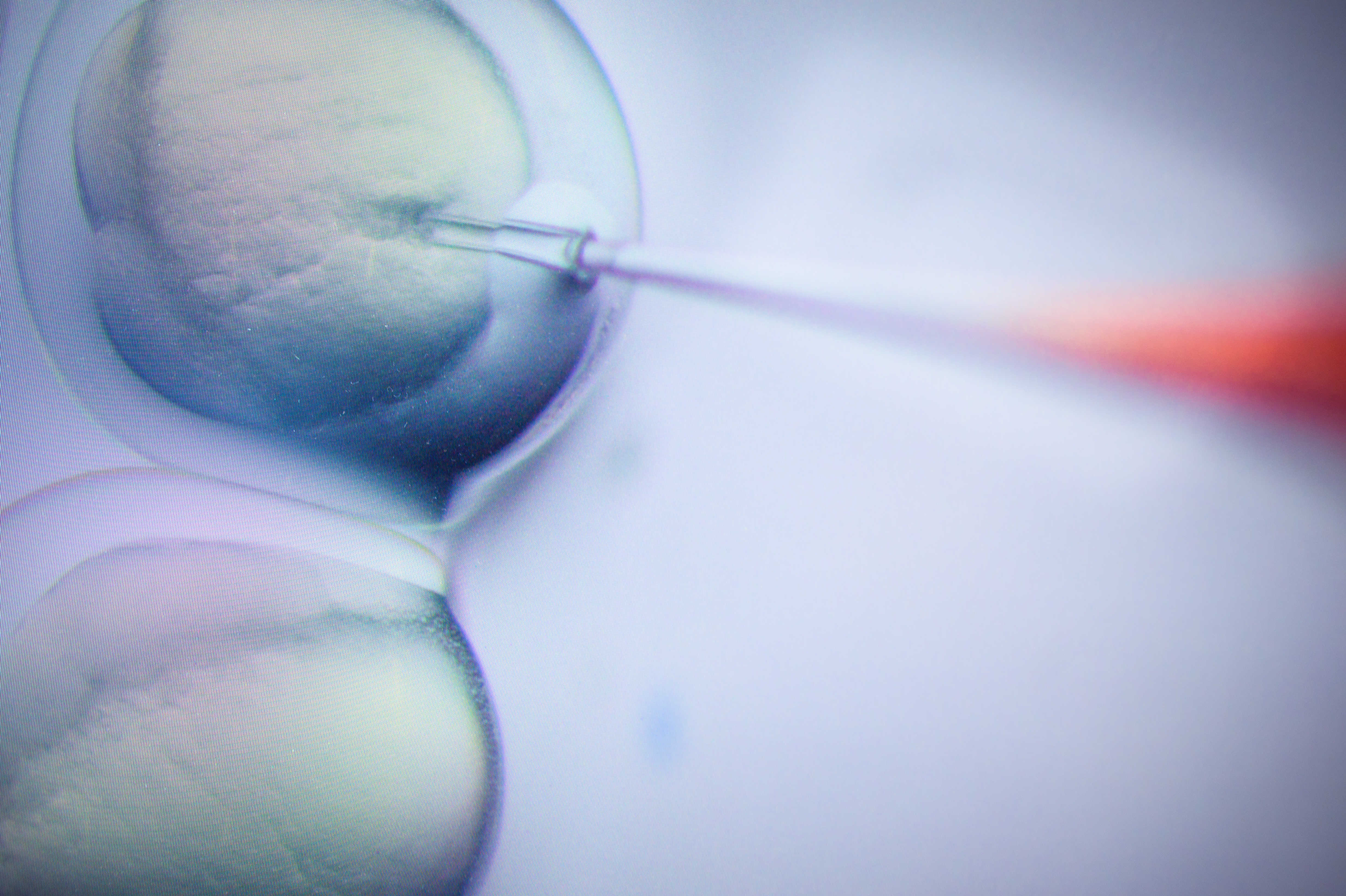 CRISPR blindness trial