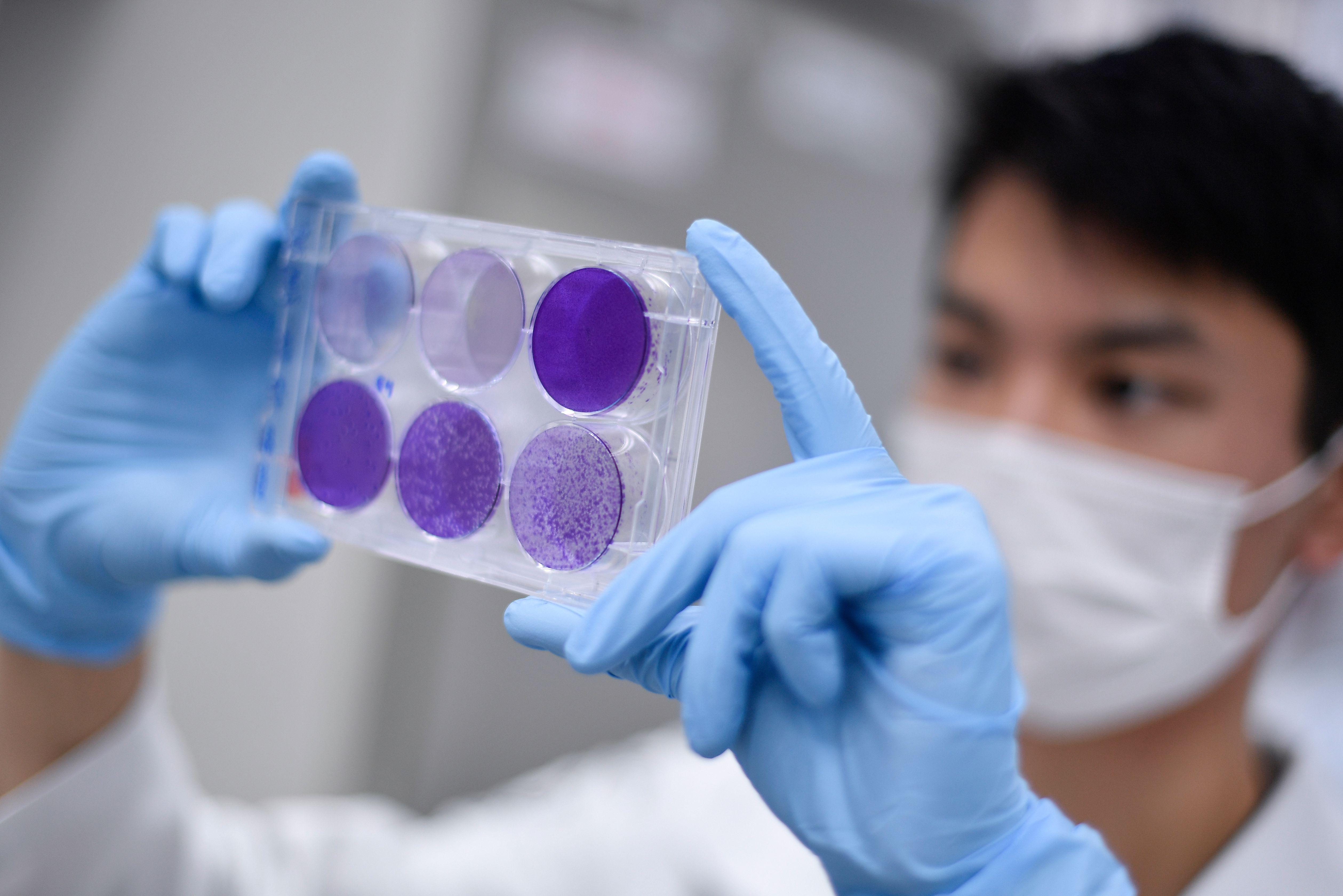 A researcher works on virus replication in order to develop a vaccine against the coronavirus COVID-19, in Belo Horizonte, state of Minas Gerais, Brazil, on March 26, 2020. - The Ministry of Health convened The Technological Vaccine Center of the Federal University of Minas Gerais laboratory to conduct research on the coronavirus COVID-19 in order to diagnose, test and develop a vaccine. (Photo by Douglas MAGNO / AFP) (Photo by DOUGLAS MAGNO/AFP via Getty Images)