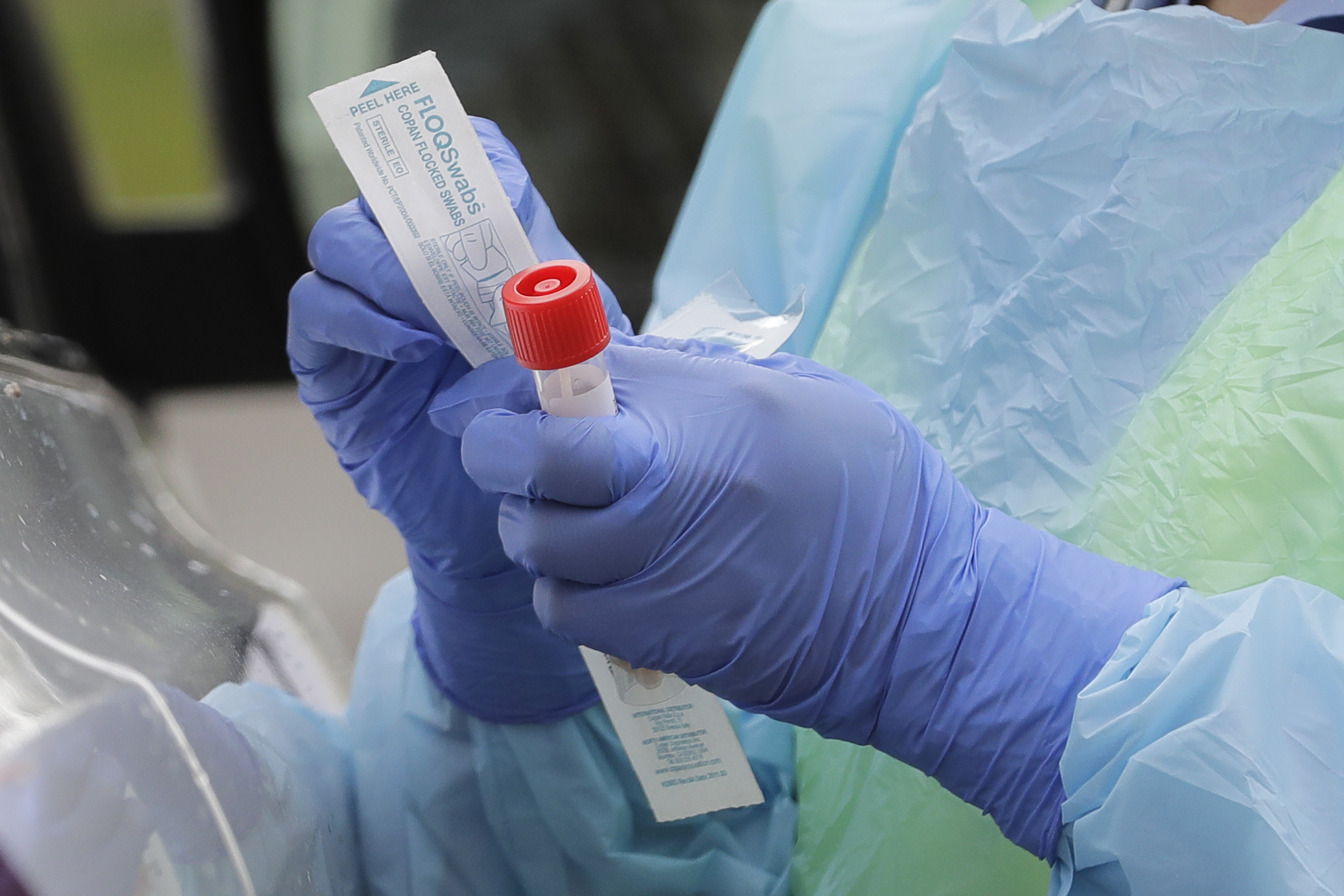 A federal report due out April 6 finds that three out of four U.S. hospitals surveyed are already treating patients with confirmed or suspected COVID-19.