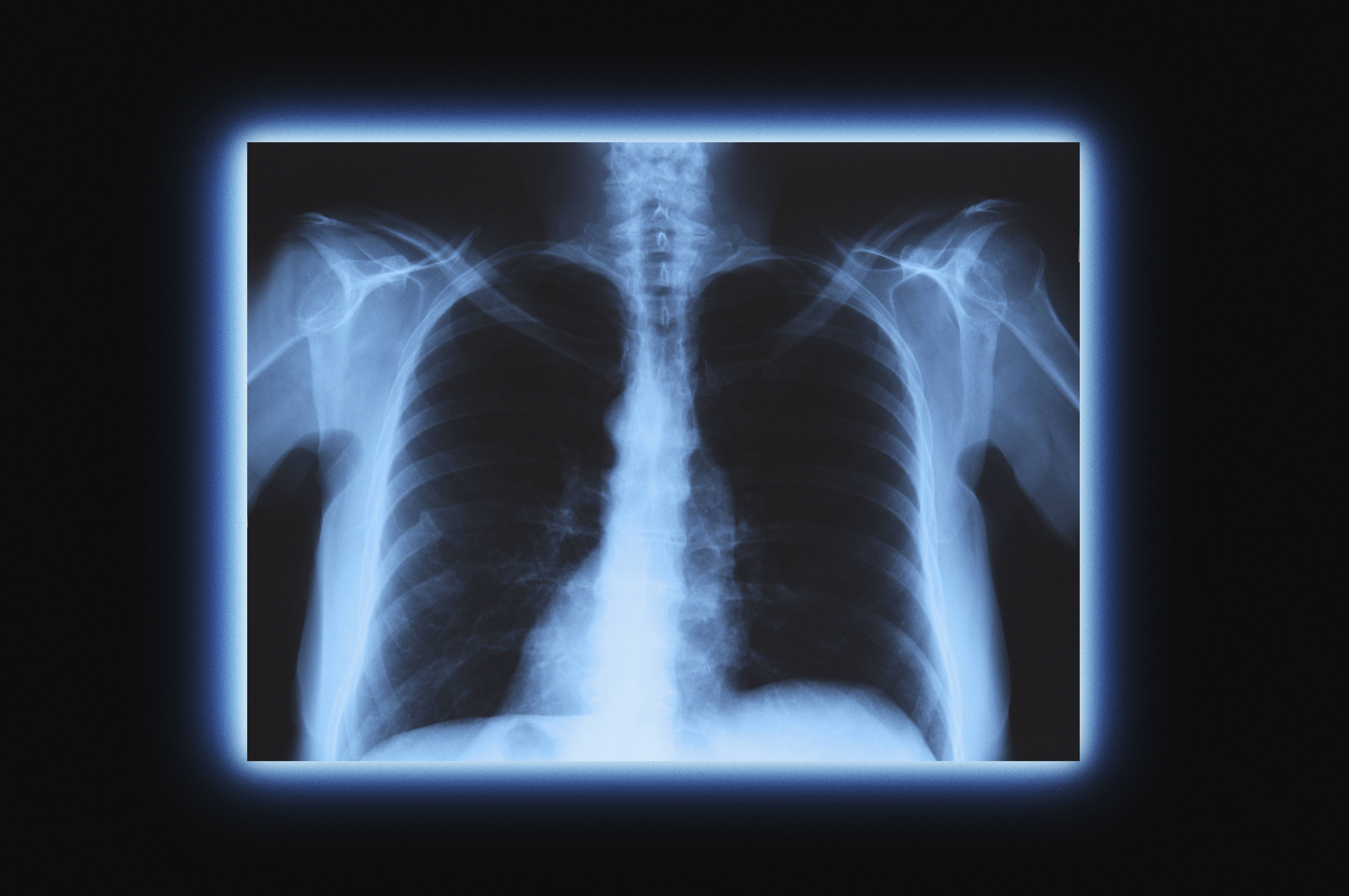 How the coronavirus pandemic highlights a problem with A.I. and medical imaging