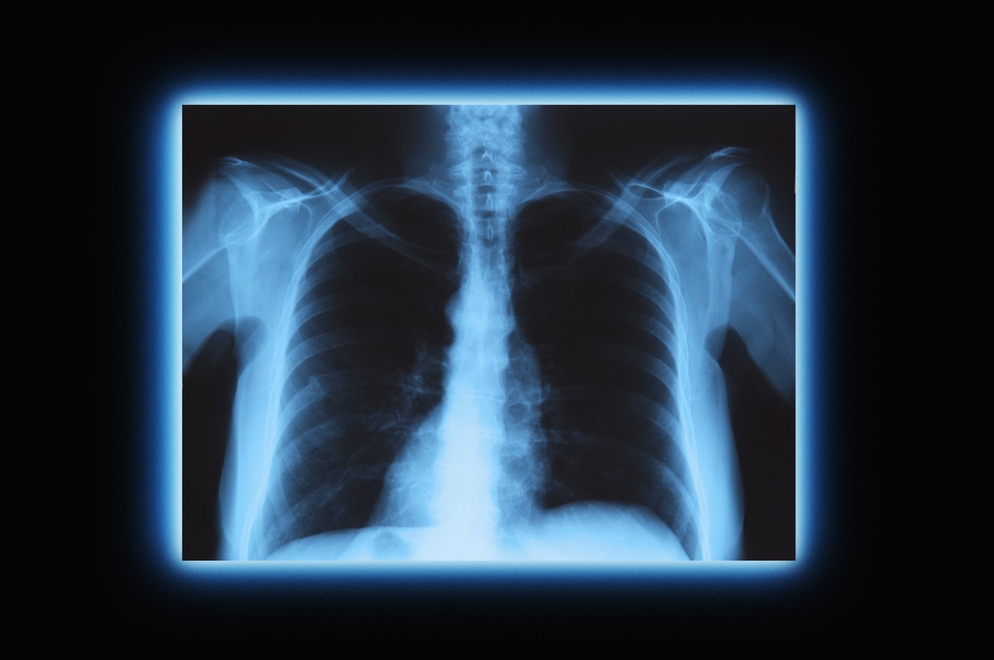 How the coronavirus pandemic highlights a problem with A.I. and medical imaging