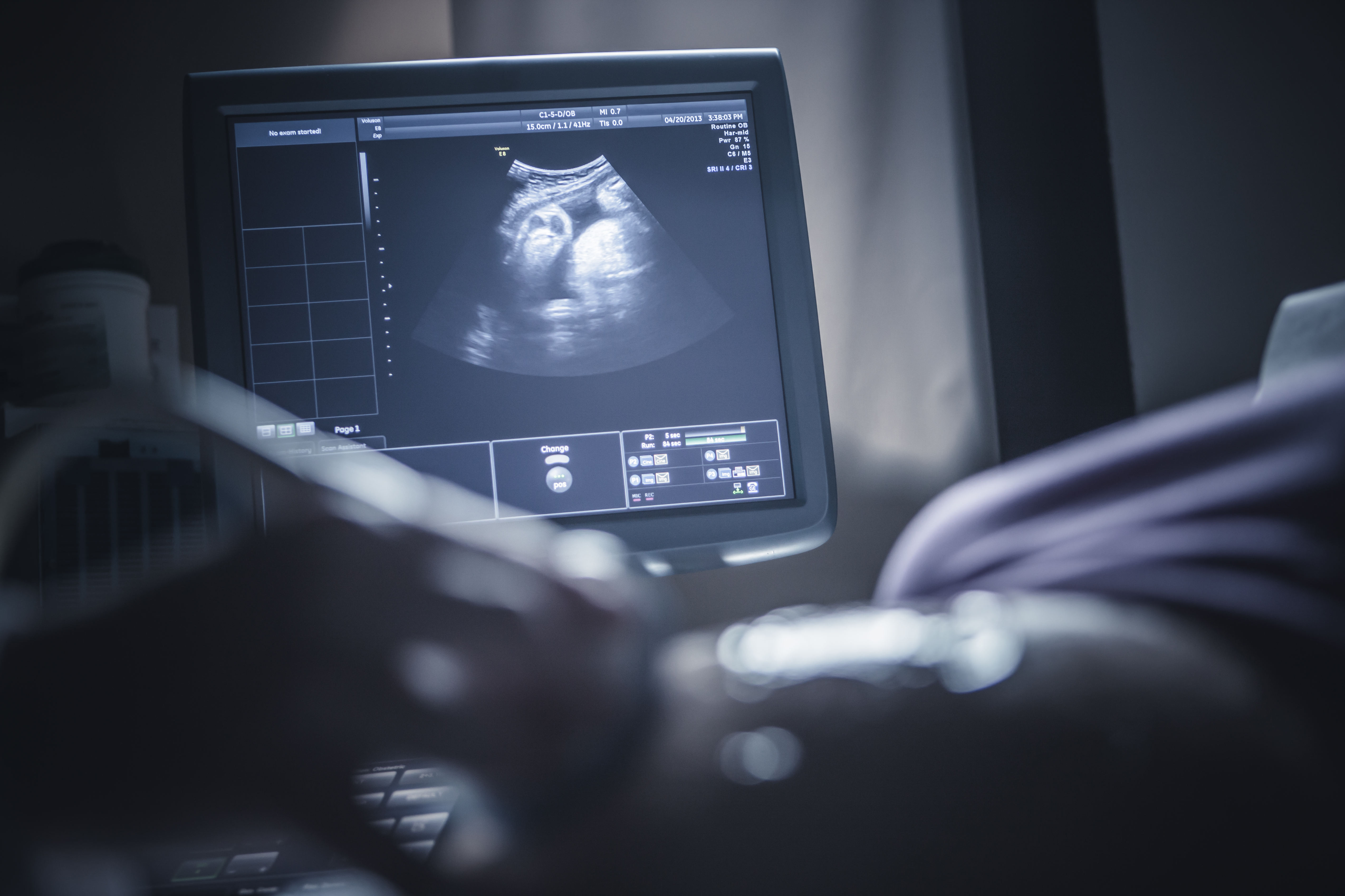 Pregnant woman having sonogram John Fedele—Getty Images