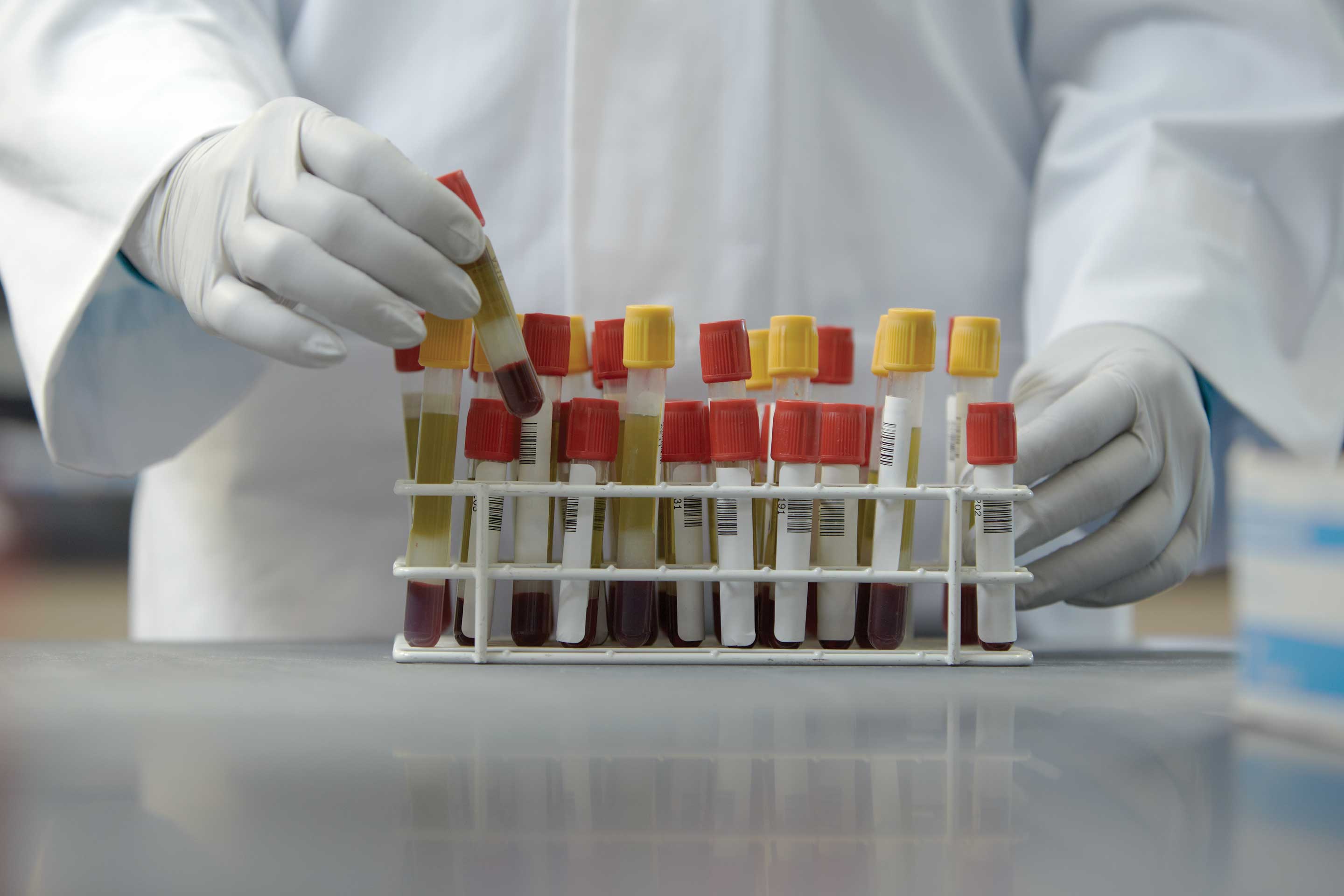 Siemens is the testing business—and has made testing employees part of its business. Courtesy of Siemens Healthineers