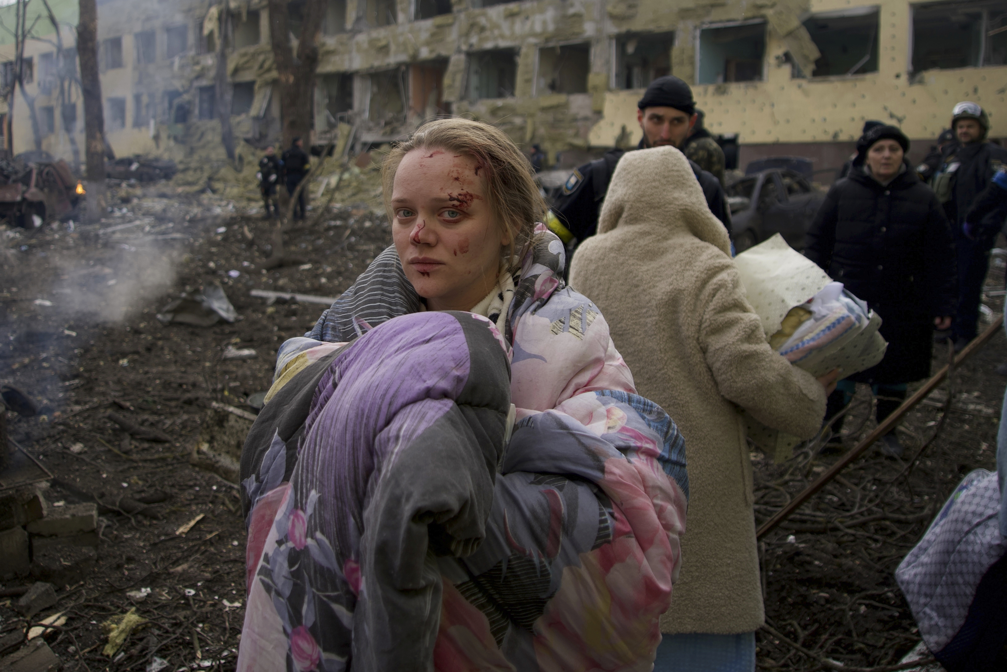 Mariana Vishegirskaya stands outside a maternity hospital that was damaged by shelling in Mariupol, Ukraine, Wednesday, March 9. Vishegirskaya survived the shelling and later gave birth to a girl in another hospital in Mariupol.