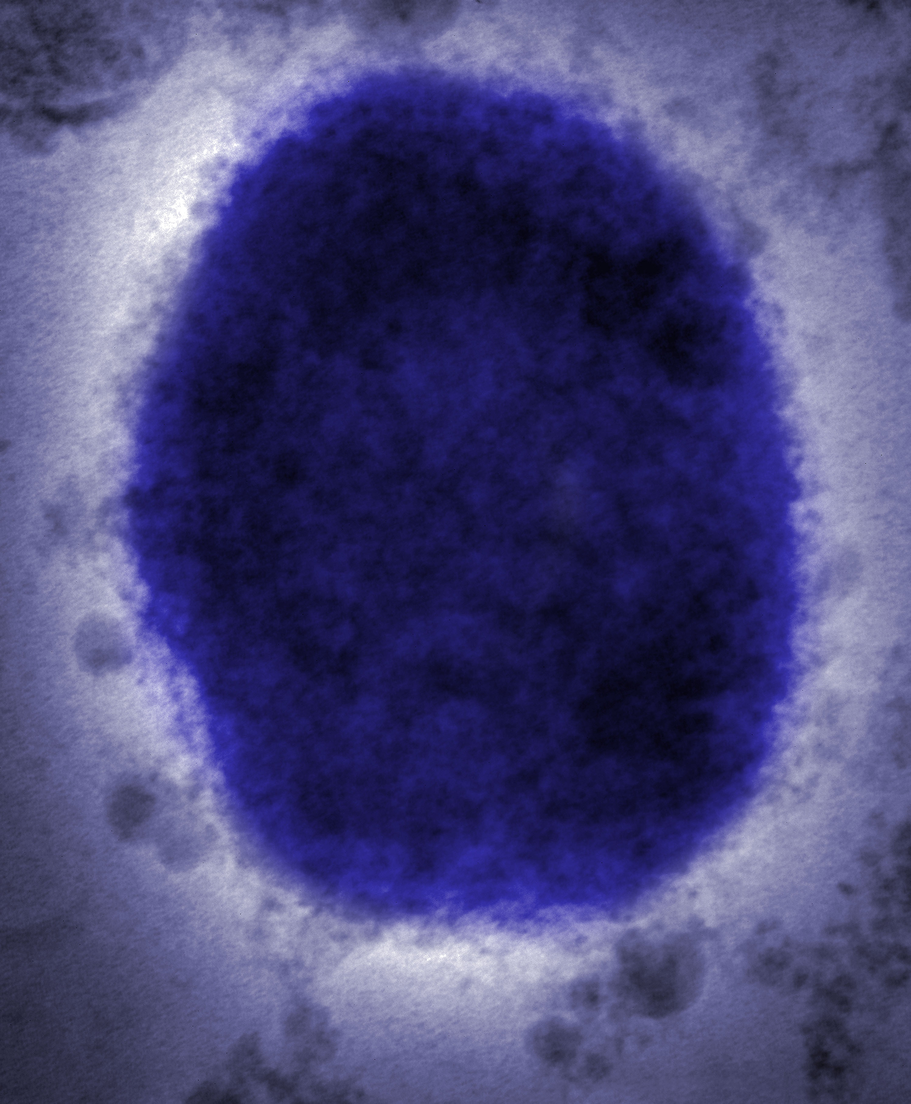The monkeypox virus.