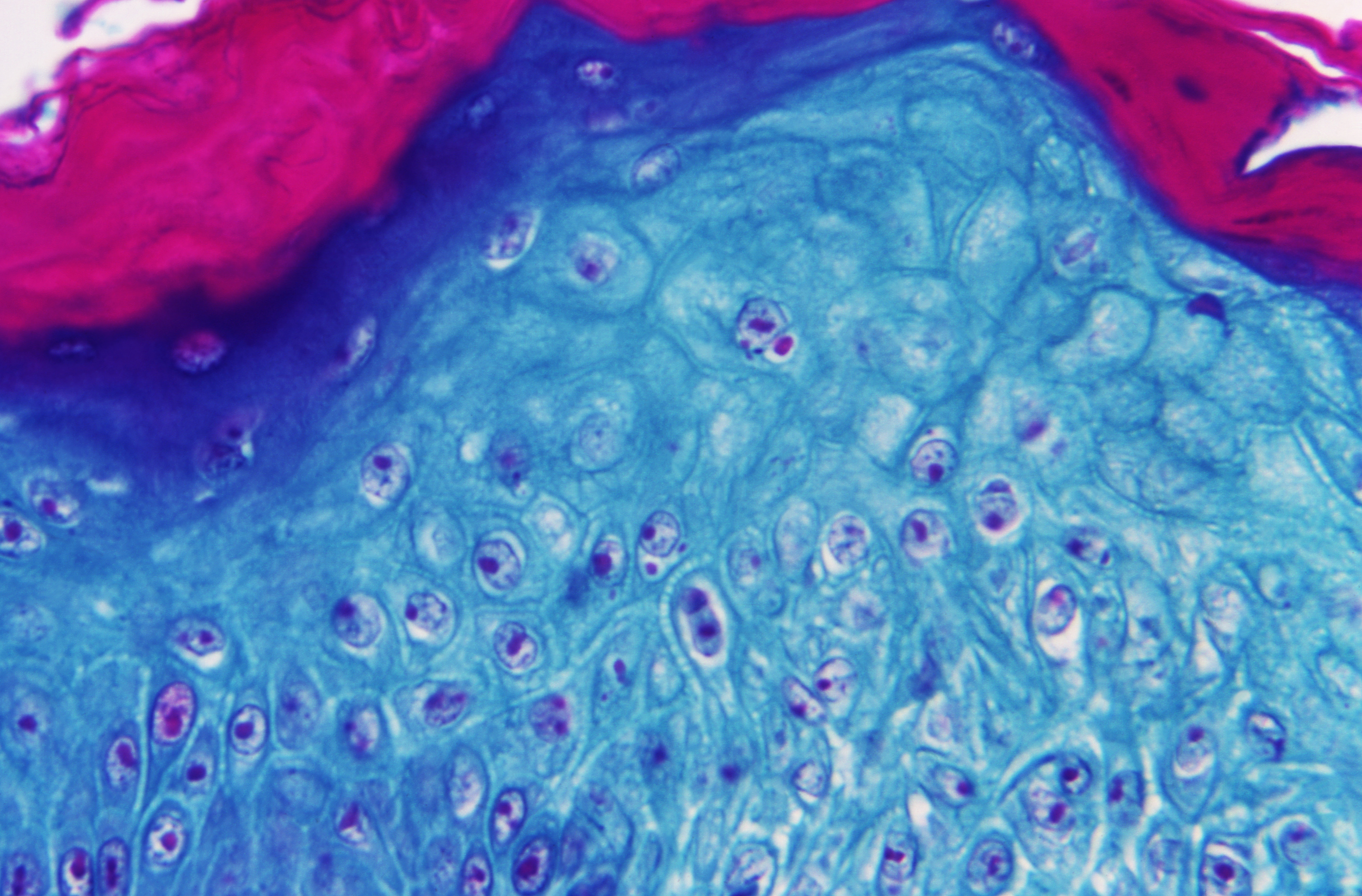 Scientists are analyzing the spread of monkeypox.
