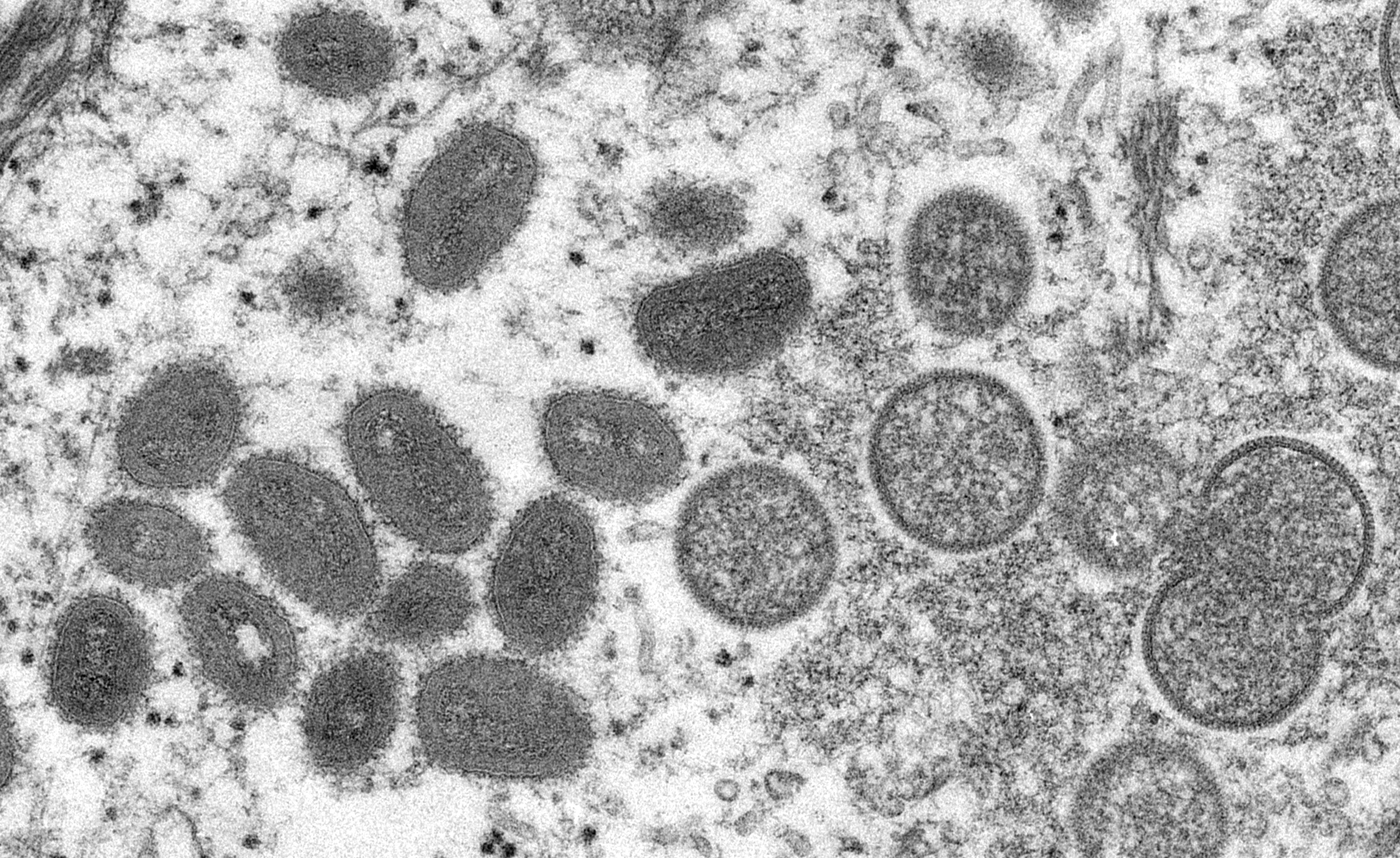 Electron microscope image of monkeypox virus particles. The CDC is urging Americans who travel to “practice enhanced precautions” as the number of outbreaks continue to grow.