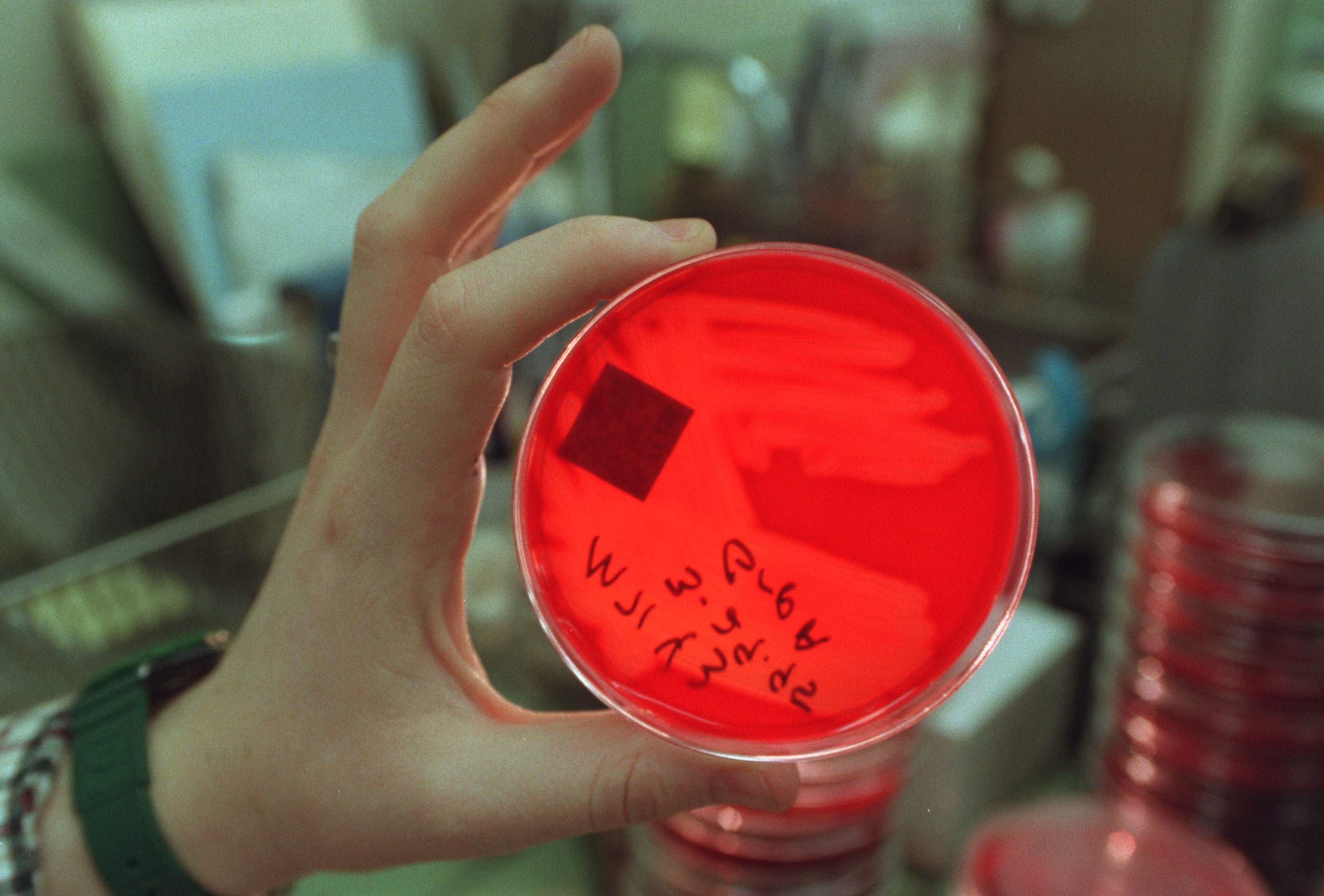 Strep A is on the rise.