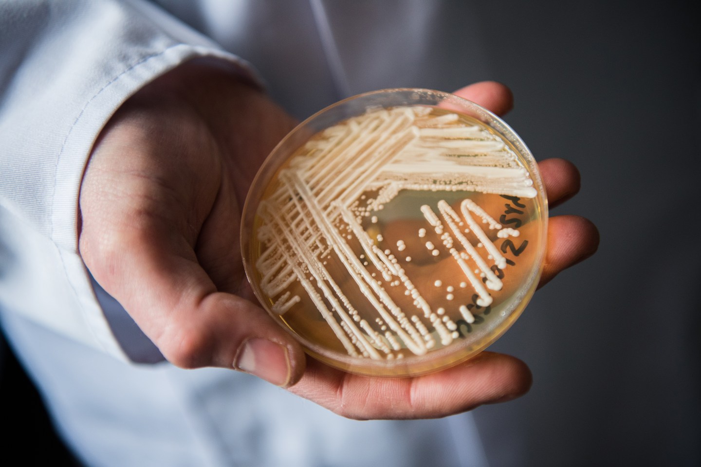 A deadly fungus is spreading across U.S. hospitals. Here’s what you need to know, according to a physician