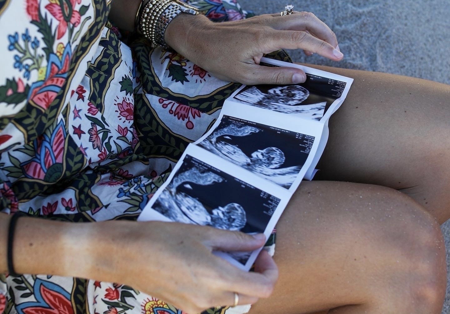 Studies have shown that up to 20% of women suffer from mood or anxiety disorders during pregnancy and postpartum.