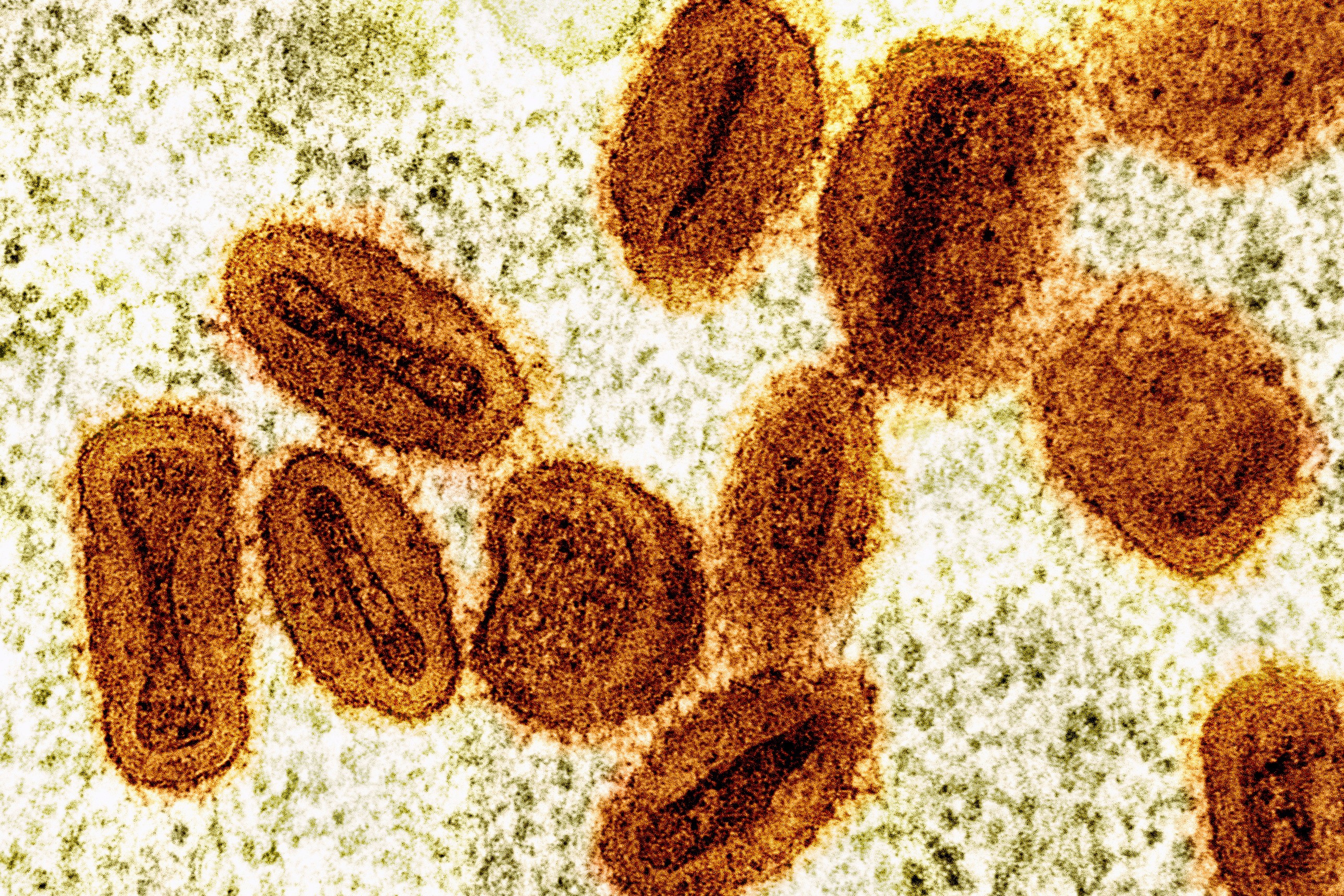 pox